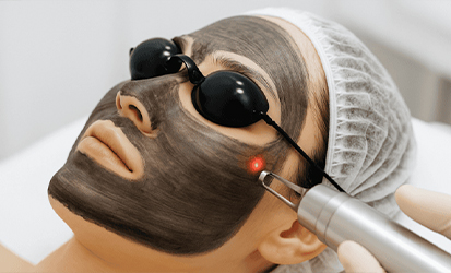 Carbon Facial